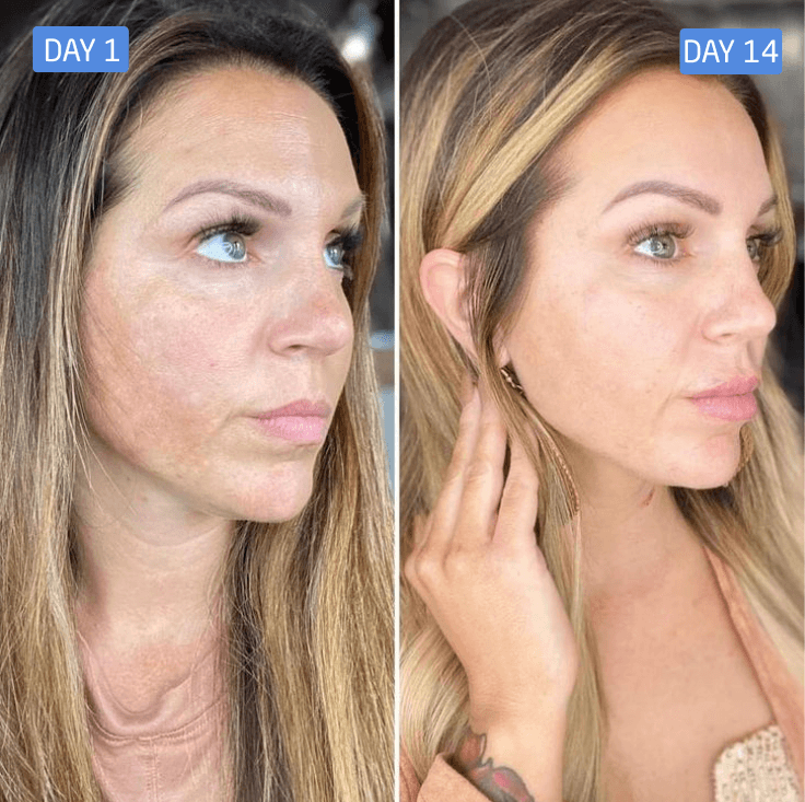 Jessica A. result photo